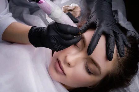 PMU-Korrekturprotokolle: Wann ist eine Korrektur angebracht und wann sollte man eine Kundin zur Laserbehandlung schicken?
